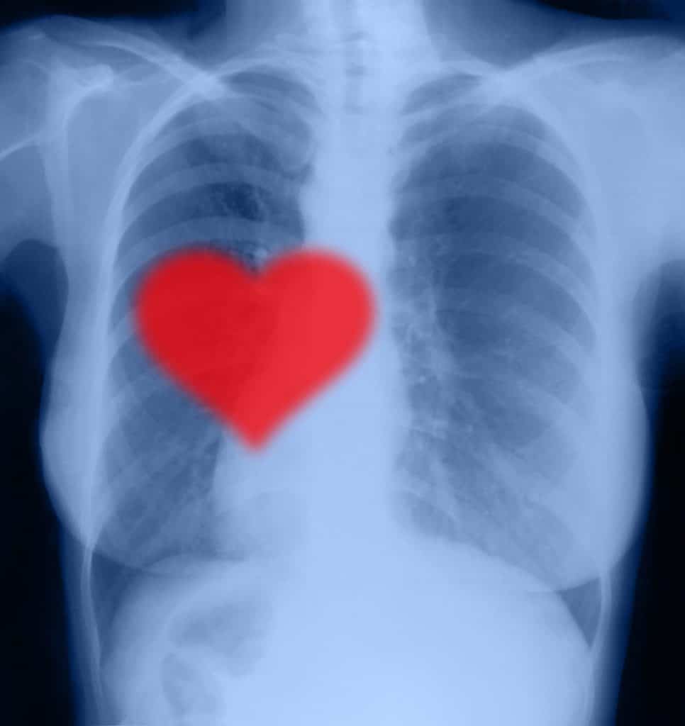 Hart vorm röntgen gekke dingen kinderen dachten